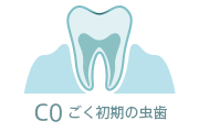 C0 ごく初期の虫歯